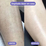 FINISHING TOUCH™ – Depiladora Laser Ultrafina + Ebook cuidado de la piel GRATIS