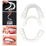 PerfectSmile™ – Carillas Dentales a Presión para una Sonrisa Inmediata